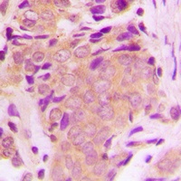 TAK1 (Phospho-T184) Antibody