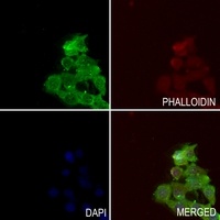 TAK1 (Phospho-T184) Antibody