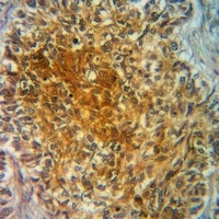TAU (Phospho-S721) Antibody