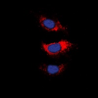 MARCKS Rabbit Polyclonal Antibody