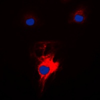 MARK2 Rabbit Polyclonal Antibody