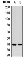 MCL1 (Phospho-S159) Antibody