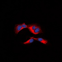 MCL1 (Phospho-S159) Antibody