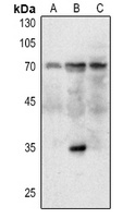 MDM2 Rabbit Polyclonal Antibody