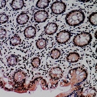 MDM2 Rabbit Polyclonal Antibody