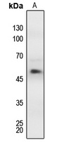 MEF2A (Phospho-T312) Rabbit Polyclonal Antibody