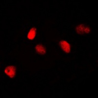 MKI67IP Rabbit Polyclonal Antibody