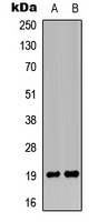 MRPL49 Rabbit Polyclonal Antibody