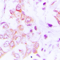 MRPL49 Rabbit Polyclonal Antibody