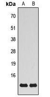 MRPS21 Rabbit Polyclonal Antibody