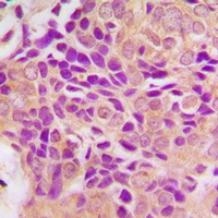 MRPS21 Rabbit Polyclonal Antibody