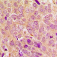 Ezrin/Radixin/Moesin (Phospho-T567/564/558) Antibody