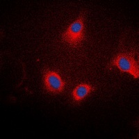 Ezrin/Radixin/Moesin (Phospho-T567/564/558) Antibody
