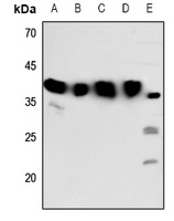 Melatonin Receptor 1b Rabbit Polyclonal Antibody