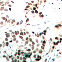 c-Myc (Phospho-T358) Antibody