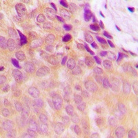NDUFS5 Rabbit Polyclonal Antibody