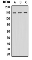 NFAT3 Rabbit Polyclonal Antibody