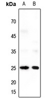 Neuromedin U Rabbit Polyclonal Antibody