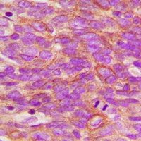 TRK A (Phospho-Y496) Antibody