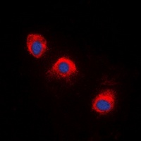 TRK A (Phospho-Y496) Antibody