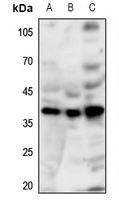 GPR86 Rabbit Polyclonal Antibody