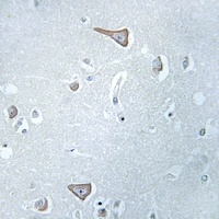 GPR86 Rabbit Polyclonal Antibody