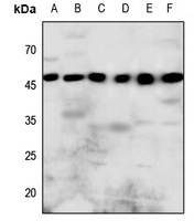 P2Y8 Rabbit Polyclonal Antibody