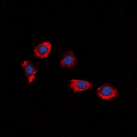 P2Y8 Rabbit Polyclonal Antibody