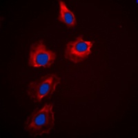 PAK1/2/3 Antibody
