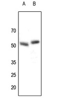Parkin Rabbit Polyclonal Antibody