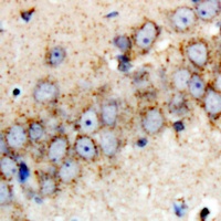 Parkin Rabbit Polyclonal Antibody