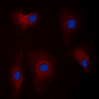 Parkin Rabbit Polyclonal Antibody