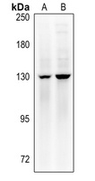 MYPT1 (Phospho-T853) Rabbit Polyclonal Antibody