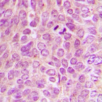 PKA C alpha/beta/gamma (Phospho-T198) Antibody