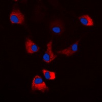 PKA C alpha/beta/gamma (Phospho-T198) Antibody