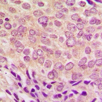 PKC alpha (Phospho-T638) Rabbit Polyclonal Antibody