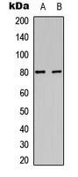 PKC alpha (Phospho-Y658) Rabbit Polyclonal Antibody