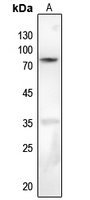 PKC beta (Phospho-S661) Rabbit Polyclonal Antibody