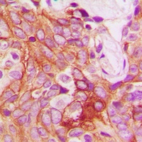 PKC beta (Phospho-S661) Rabbit Polyclonal Antibody