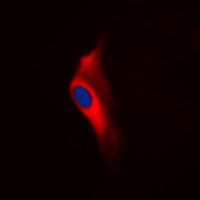 PKC epsilon (Phospho-S729) Antibody