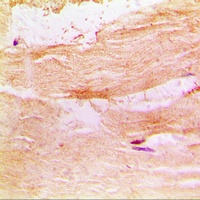 PKC theta Rabbit Polyclonal Antibody