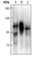 PRKD2 Rabbit Polyclonal Antibody