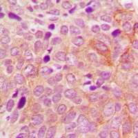 PRKD2 Rabbit Polyclonal Antibody