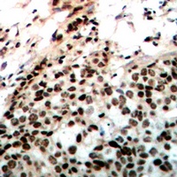 DNA-PKcs (Phospho-T2647) Antibody