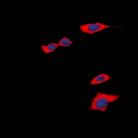 PGD2 Receptor Rabbit Polyclonal Antibody