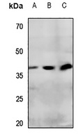 IP Receptor Rabbit Polyclonal Antibody
