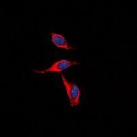 IP Receptor Rabbit Polyclonal Antibody