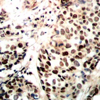 RAD51A Rabbit Polyclonal Antibody
