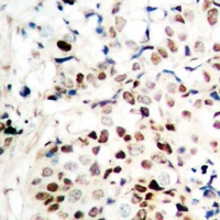 CTIP Antibody