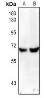 NF-kappaB p65 Rabbit Polyclonal Antibody